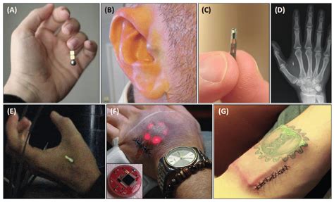 tracking kids rfid subdermal|rfid microchips.